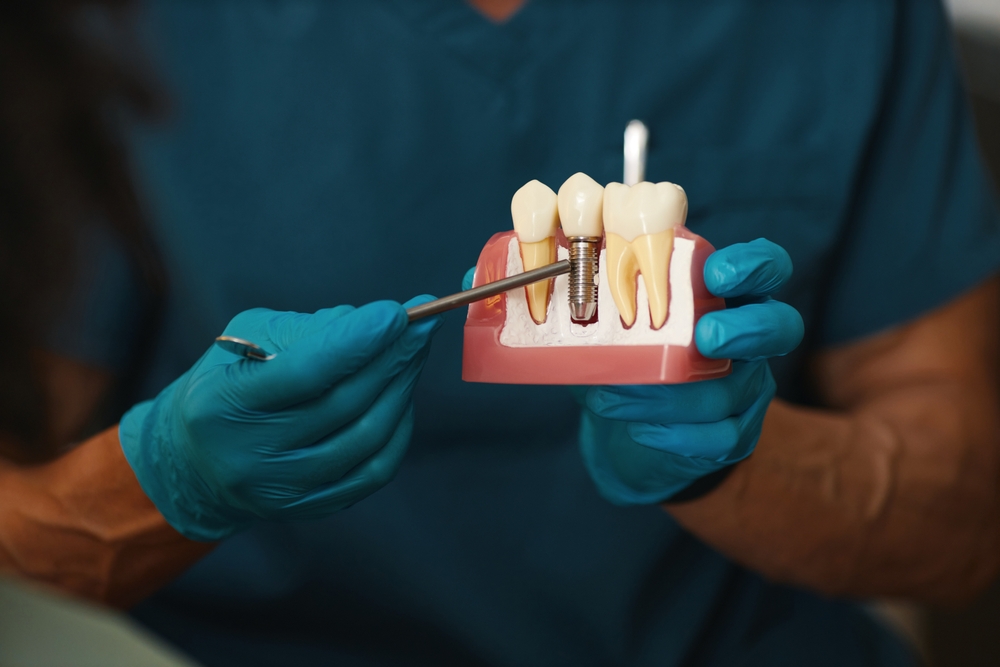 Am I A Candidate for Dental Implants? Dentist in Davis, CA. Dr. Amir Nojouimi, Dr. Pouya Namiranian. Davis Oral Surgery & Implant Center