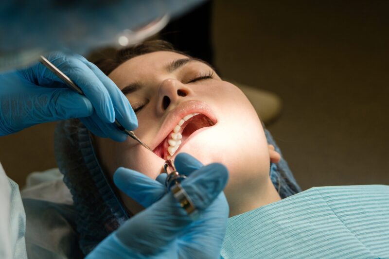 Wisdom Teeth Davis